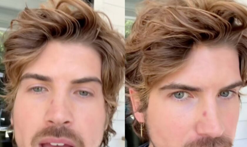 YouTuber Joey Graceffa reveals he’s been diagnosed with skin cancer