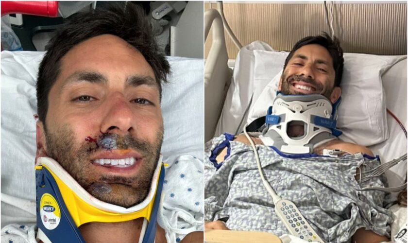 Catfish host Nev Schulman ‘lucky to be alive’ after breaking his neck in bike accident