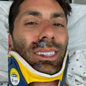 The Catfish presenter shared a photo of himself on social media. Pic: Nev Schulman/Instagram