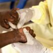 Viruskrankheit: WHO ruft wegen Mpox weltweite Notlage aus