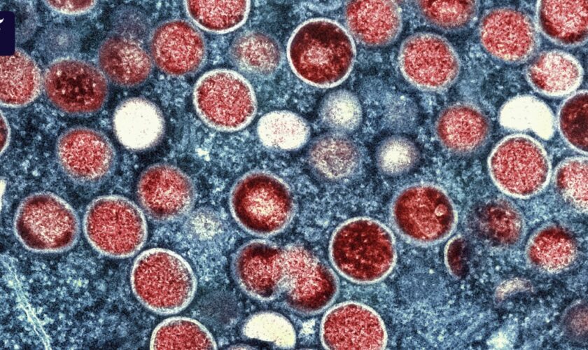 China erschwert Einreise für Menschen aus Mpox-Gebieten