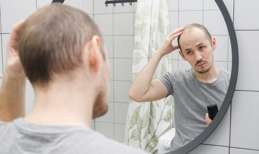 Cure for men's hair loss could be found in sugar stored in the body, study suggests