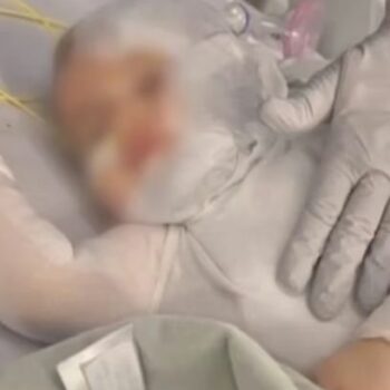 Baby boy suffers severe burns after stranger pours scalding coffee over him