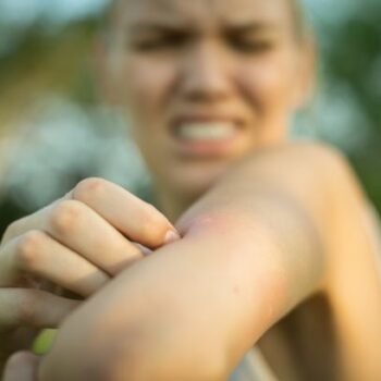 'Biting insect invasion' warning amid hot weather forecast