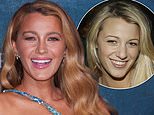 Blake Lively's cosmetic surgery transformation revealed... how the star, 37, made subtle tweaks that changed her looks, claims top cosmetic doctor