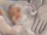 Coorparoo: Harrowing footage emerges of nine-month-old boy's injuries after stranger poured scalding coffee over him in a Brisbane park