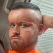 Horror hair dye reaction left man, 27, with a giant 'BALLOON HEAD' like the cartoon character Megamind