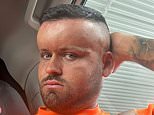 Horror hair dye reaction left man, 27, with a giant 'BALLOON HEAD' like the cartoon character Megamind