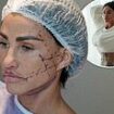 Katie Price brushes off arrest warrant as she goes in for her SIXTH £10,000 facelift at a clinic in Turkey after she skipped her bankruptcy hearing