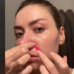 Le « face taping », la nouvelle tendance TikTok « inutile et dangereuse » pour gommer les rides