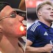 Man United star Rasmus Hojlund undergoes £1,400 laser acne treatment after his skin 'blew up'