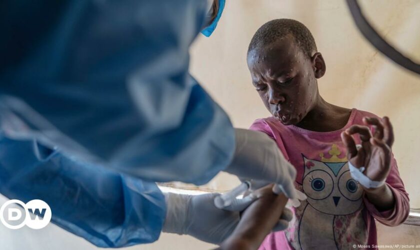 Mpox outbreak: DR Congo lacks vaccines to curb infections