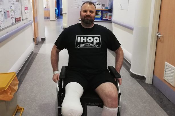 Plumber's leg has to be amputated after bending down to pick up a pack of screws