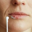 Stiftung Warentest zu Lippenherpes-Mitteln: »Für kein einziges Mittel ist eine rasche Wirkung belegt«