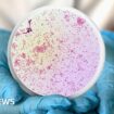 Warning over antibiotic-resistant gonorrhoea cases