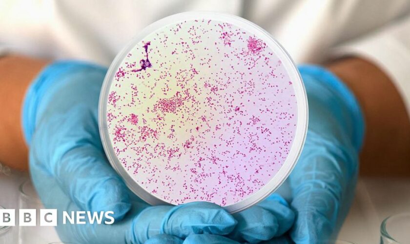 Warning over antibiotic-resistant gonorrhoea cases