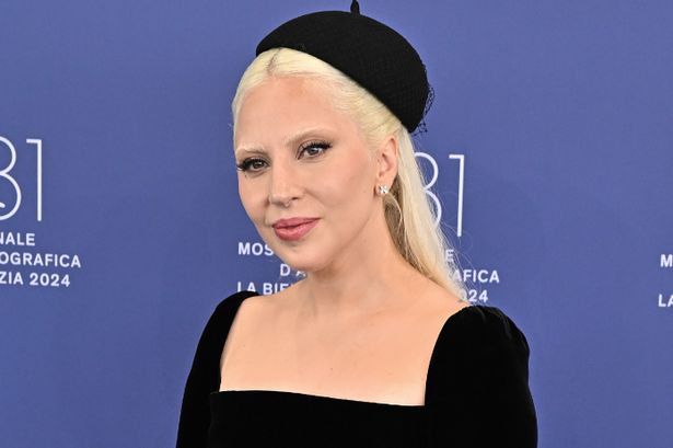 Lady Gaga issues health update after devastating condition left her 'head to toe in pain'