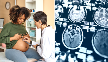 During pregnancy, a woman's brain experiences 'profound changes,' new study finds