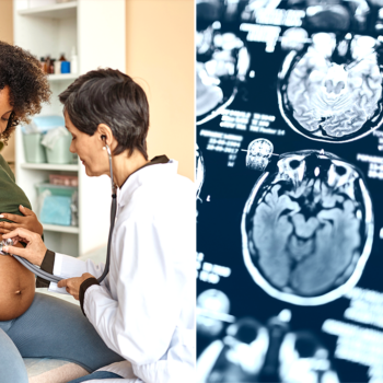 During pregnancy, a woman's brain experiences 'profound changes,' new study finds