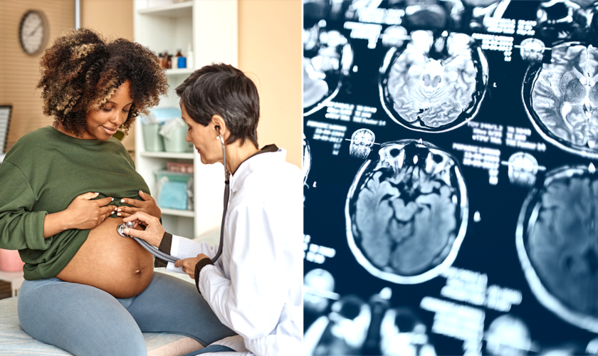 During pregnancy, a woman's brain experiences 'profound changes,' new study finds