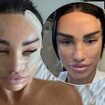 Katie Price insists she 'trusts the process' of her SIXTH surgical facelift as she shares a clip of her lengthy recovery - after being warned she could suffer 'stroke symptoms'