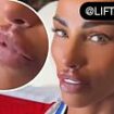 Katie Price says her face is finally 'complete' as she shows off her plumper pout after getting her lips filled - but admits she's already planning work on another body part