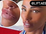 Katie Price says her face is finally 'complete' as she shows off her plumper pout after getting her lips filled - but admits she's already planning work on another body part