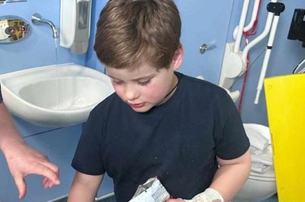 Mum's 'worst fear' comes true as autistic son, 7, suffers horror burn in split-second kitchen accident