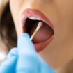 Simple swab test in your mouth 'reveals how long you have left to live'