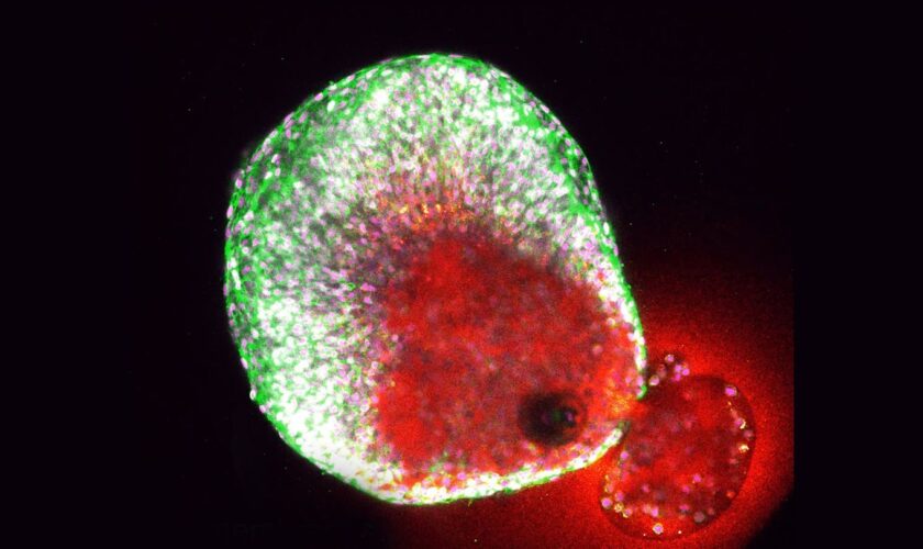 Drei Phasen: Wissenschaftliche Sensation: Erstmals Eisprung in Echtzeit gefilmt