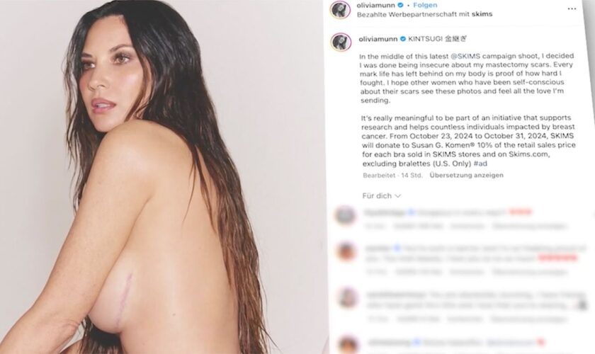 Fotoshooting für Kardashian: Hollywood-Star Olivia Munn zeigt Narben nach Brustkrebs-OP