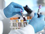 New blood test could be able to detect signs of 12 most common cancers before symptoms develop