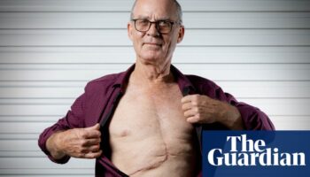 ‘I couldn’t believe it’: routine GP checkup reveals 2kg tumour growing in Brisbane man’s liver