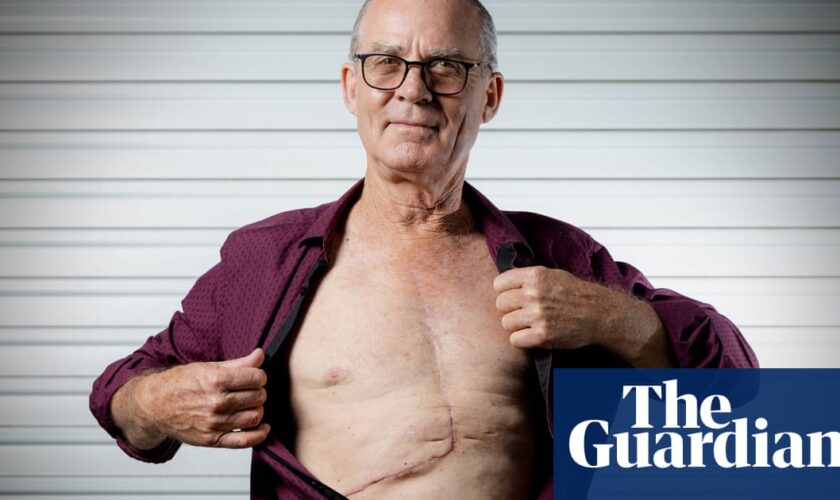 ‘I couldn’t believe it’: routine GP checkup reveals 2kg tumour growing in Brisbane man’s liver