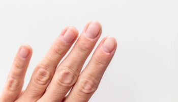 How to stop dry and cracked cuticles