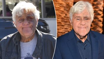 Jay Leno ‘feeling good’ despite suffering bruised face from fall