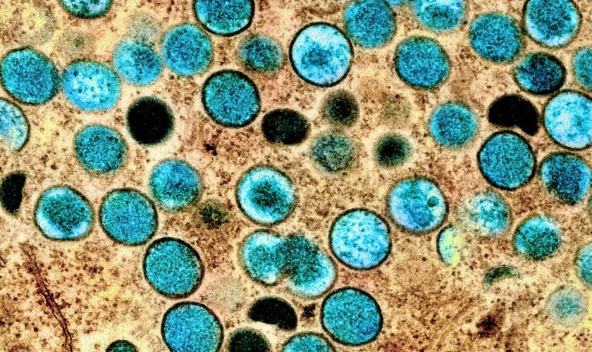 Mpox virus particles shown in a laboratory photo. Pic: NIAID handout via Reuters