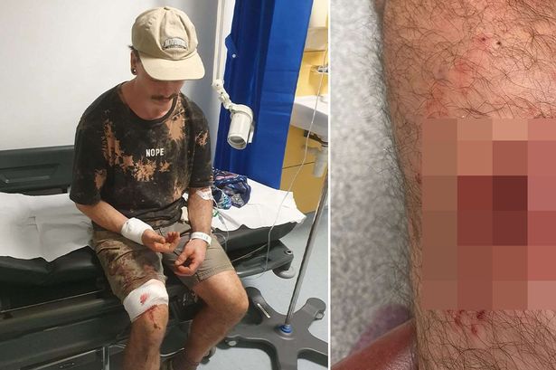 Bike technician 'left for dead' after being attacked by 'Rottweiler' in woods