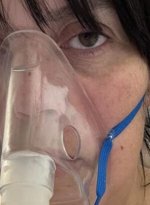 'I thought vaping was healthy, X-ray after weeks in hospital tells the truth'