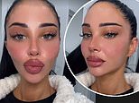 Tulisa reveals shocking results of swollen TATTOOED lips as she treats herself to cosmetic procedure for I'm A Celeb makeover