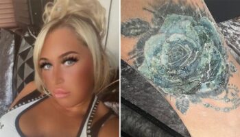 'Turkey holiday tattoo infection left me facing having my foot amputated'