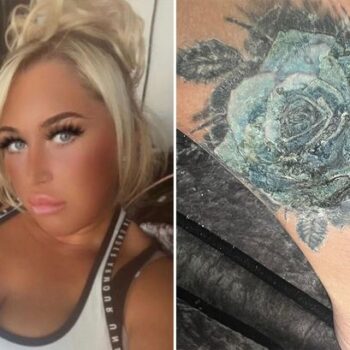 'Turkey holiday tattoo infection left me facing having my foot amputated'