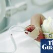 UK austerity policies ‘increased rate of premature and low birth weight babies’