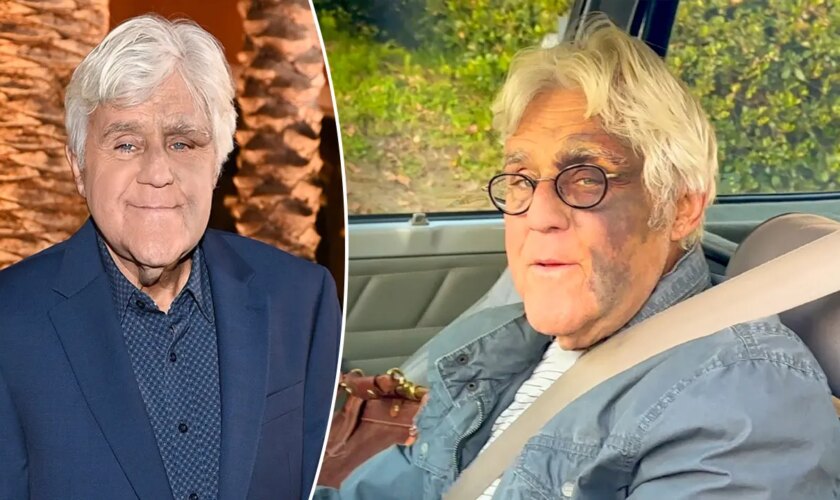 Jay Leno addresses rumors his facial injuries were related to mob retaliation