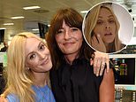 Fearne Cotton reveals she is having surgery on two tumours on her jawline and says she has been supported by friend Davina McCall