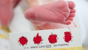 Ein Bluttropfen vom Fuß eines Babys genügt, um viele Krankheit zu erkennen. (Archivbild) Foto: picture alliance / Stefan Sauer/d