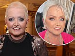 Linda Nolan, 65, suffers horror fall and 'knocks out' her teeth amid ongoing battle with cancer - after revealing she 'never expected to make it this far'