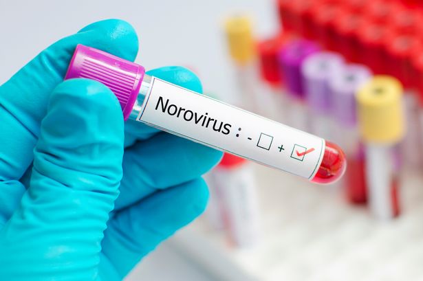 Norovirus symptoms to watch out for as families issued urgent 'stay indoors' warning