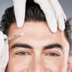 Why more and more men are shouting about their Botox habit