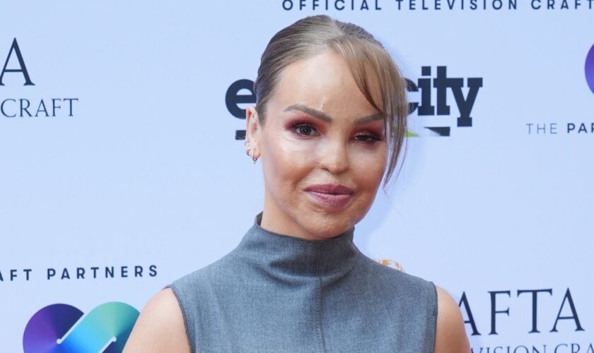 Katie Piper reveals artificial eye decision - 16 years after acid attack